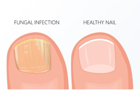 Kerassentials Kerassentials